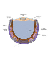 Top Crown (Clearance)